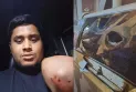 হাসনাতের গাড়িতে হামলা : গাজীপুরে ১০০ জনের নামে মামলা