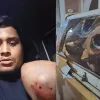 হাসনাতের গাড়িতে হামলা : গাজীপুরে ১০০ জনের নামে মামলা