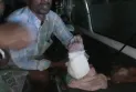 কুড়িগ্রামে মর্টারশেল বিস্ফোরণে এক ব্যক্তির ডান পায়ের গোড়ালী বিচ্ছিন্ন 