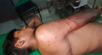 কুড়িগ্রাম সীমান্তে বিএসএফের রাবার বুলেটে বাংলাদেশী যুবক আহত