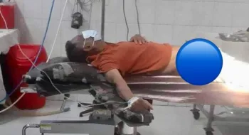 অণ্ডকোষ ফেটে গেছে সাবেক বিচারপতি মানিককের