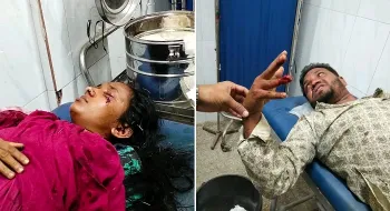 কুড়িগ্রামে পুলিশের সোর্স ভেবে ইউপি সদস্যকে কোপালেন ইয়াবা ব্যবসায়ী