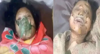 নীলফামারীতে গ্যাস সিলিন্ডার বিস্ফোরণে দুইবোনের মধ্যে একজনের মৃত্যু
