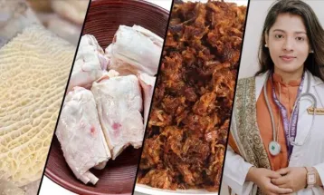 ঈদের বিশেষ খাবার: কারা খাবেন, কারা নয়, জানালেন পুষ্টিবিদ