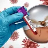 ডেঙ্গুতে ৯ জনের মৃত্যু, হাসপাতালে ভর্তি ১০৪২