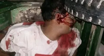 ‎তিস্তা নদী রক্ষা আন্দোলন থেকে ফেরার পথে ট্রাকচাপায় কলেজ শিক্ষক নিহত