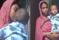 বিরল রোগ সিফাতের মাথা জুড়ে বেঁধেছে বাসা ধীরে ধীরে করছে  গ্রাস