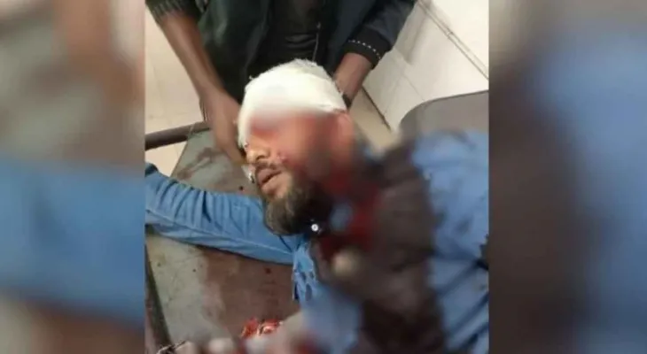 এবার এনসিপি বিভাগীয় প্রধানের মাথায় গুলি